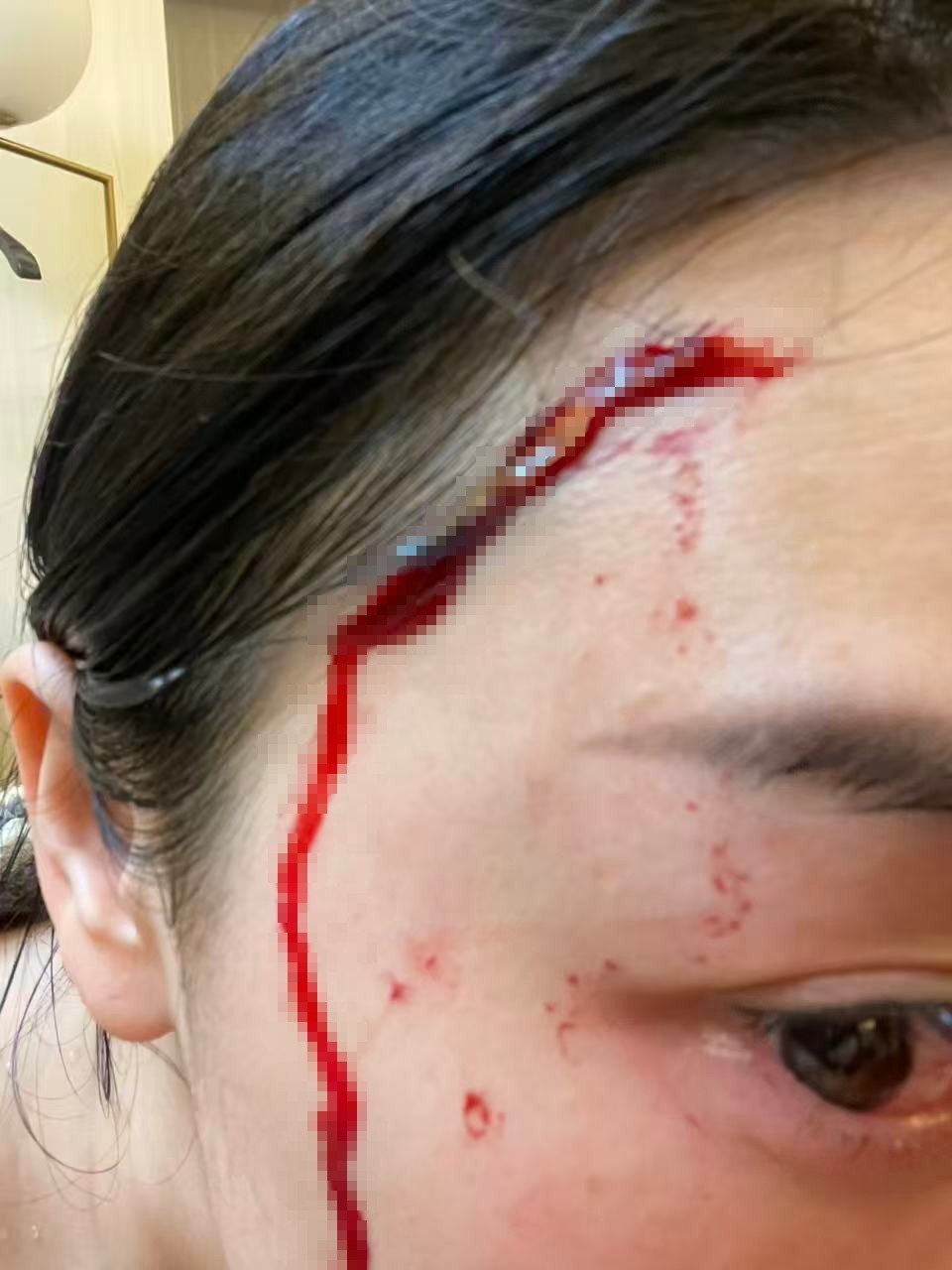 长沙一女子洗澡时浴室玻璃突然自爆致受伤,开发商:已超质保期,会妥善回应业主诉求 长沙一女子洗澡时浴室玻璃突然自爆致受伤,开发商:已超质保期,会妥善回应业主诉求