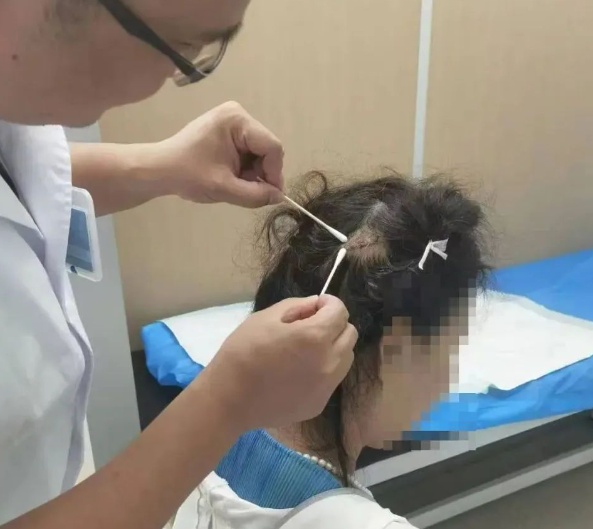 看似温柔的盘发“神器”，有时会成为利刃，一定要小心！