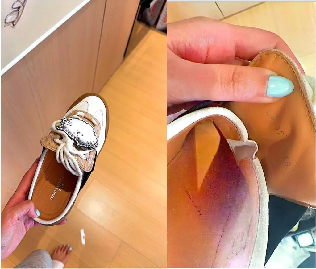 上海女子近万元购入大牌运动鞋，穿了十分钟后双脚破皮留疤需整形！客服：不能退