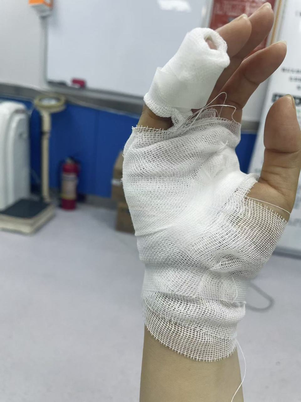 长沙一女子洗澡时浴室玻璃突然自爆致受伤,开发商:已超质保期,会妥善回应业主诉求 长沙一女子洗澡时浴室玻璃突然自爆致受伤,开发商:已超质保期,会妥善回应业主诉求