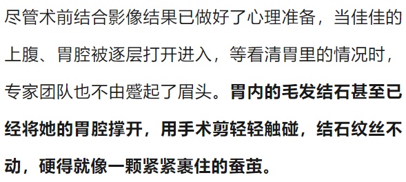 密密麻麻，杭州姑娘体内取出2斤！医生傻眼：你都25岁了...