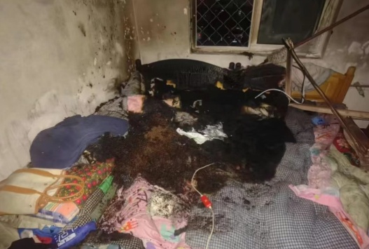 电热毯别开整夜 当心“烙”出烫伤