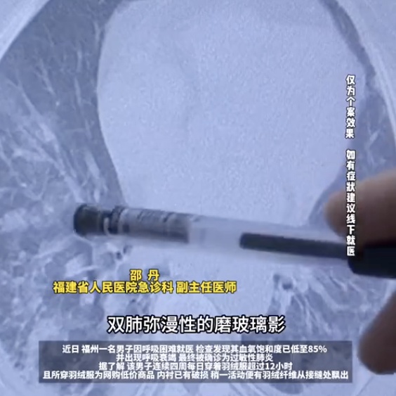 男子穿破损羽绒服确诊肺炎，呼吸困难血氧大降！医生紧急提醒