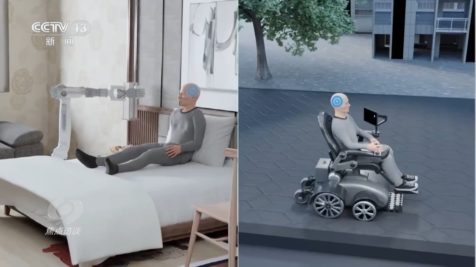 焦点访谈｜“心想”变“事成”！“十五五”规划建议布局脑机接口产业