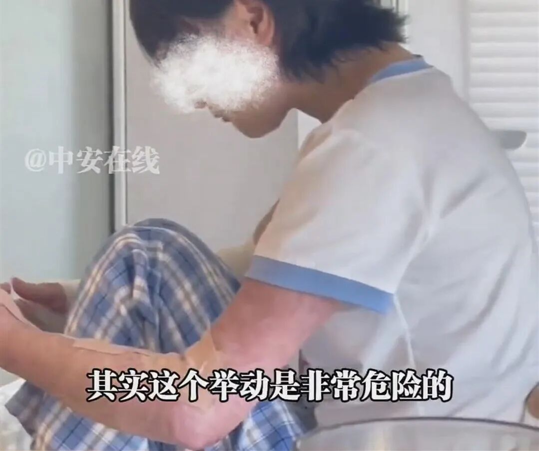 又一起！全身70%烧伤！睡觉时真的别这么做了