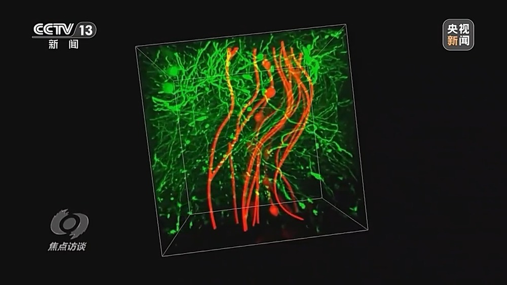 焦点访谈丨从实验室走向产业化 脑机接口让科幻照进现实