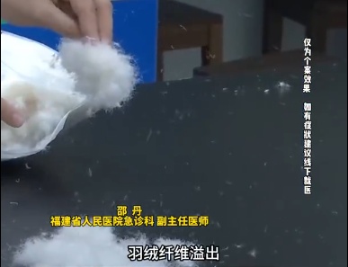 男子确诊“羽绒肺”呼吸衰竭！医生提醒→