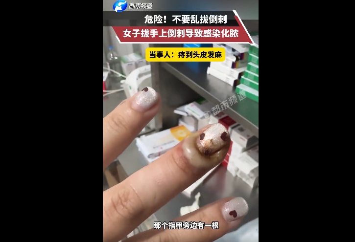 不要拔！不要拔！有人因此进急诊、拔甲、截肢！