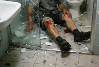 冬季多发！家中的这块玻璃，正在威胁着你家人的安全