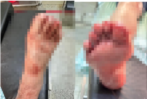 冬季多发！家中的这块玻璃，正在威胁着你家人的安全