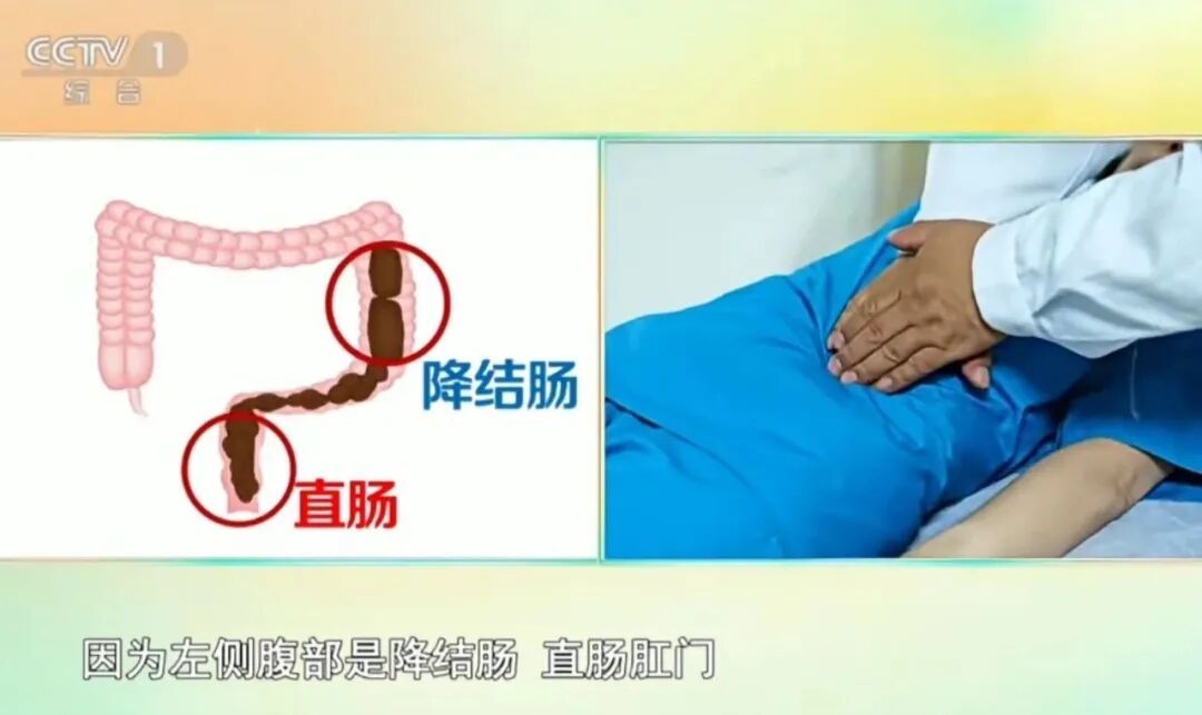 不用吃药，中医5招帮你缓解便秘