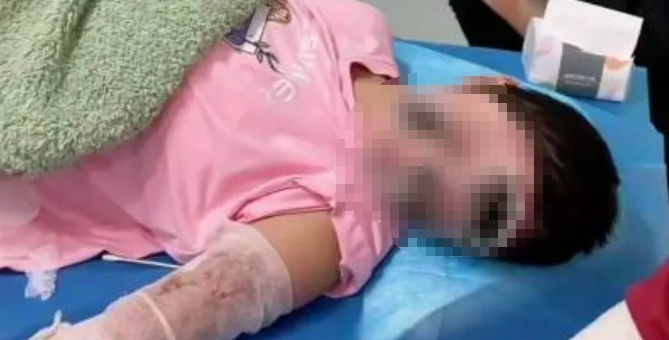 湖北一女子全身70%烧伤!睡觉时,这些习惯很多人都有,赶紧自查 湖北一女子全身70%烧伤!睡觉时,这些习惯很多人都有,赶紧自查