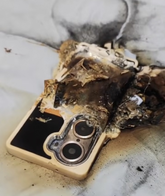 全身70%烧伤！女子含泪表示：一定改掉这个睡前习惯