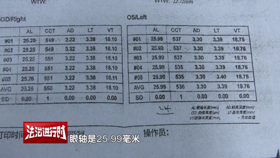 北京：为治近视连续按摩 不料视力越来越差