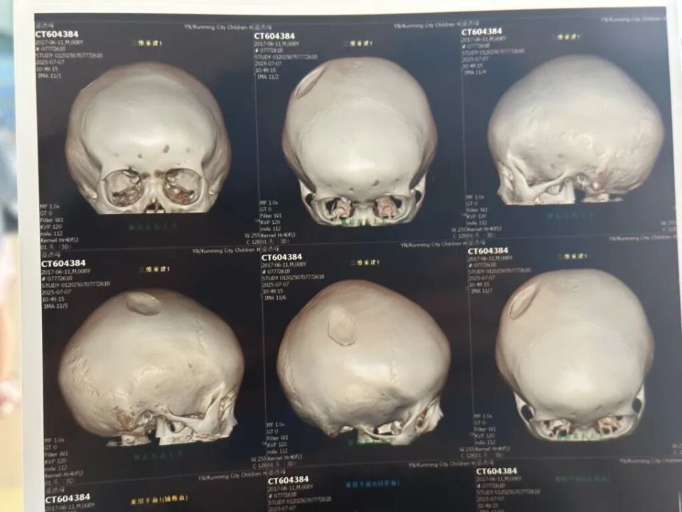 男子酒后抡椅砸人误伤8岁男童，因寻衅滋事罪获刑二年，该男子曾因酒后闹事两度被拘留