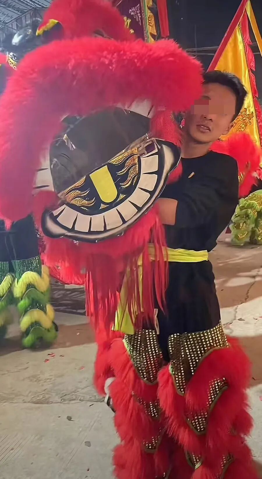 全网心疼！16岁舞狮少年意外坠落，或终生靠呼吸机生存？上海天花板级专家出手