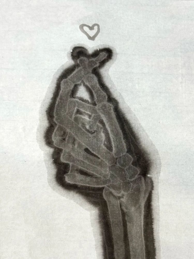 学医和学画的都惊呆了！医生手绘X光片“走红”