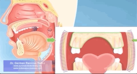 “口呼吸”会让人变丑？闭口贴能解决口呼吸？