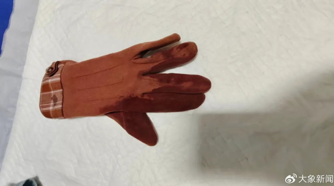 男子街头挥刀乱刺，被休假女警一脚踢落凶器！女警面部缝合30余针，手套被血浸透……