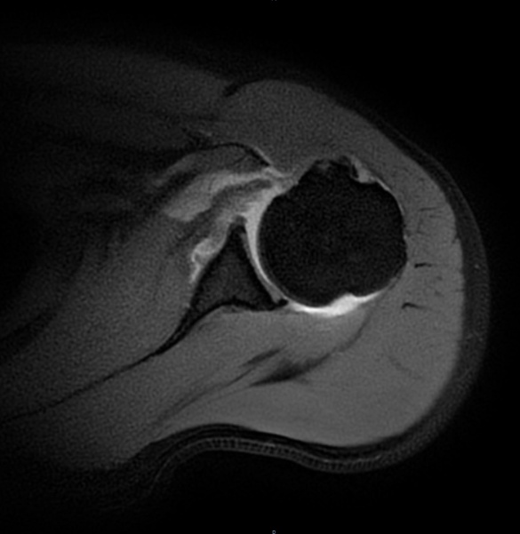 小伙猛发力后“啪”一声，进了手术室！这游戏很多人爱玩，医生提醒