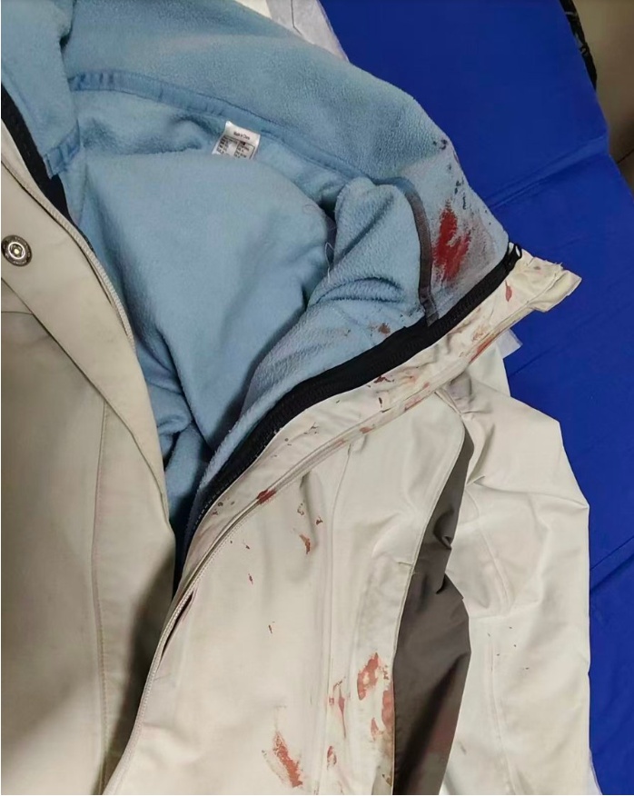 男子街头挥刀乱刺，休假女警徒手夺刀，面部多处被划伤，强忍剧痛拦住逃窜歹徒