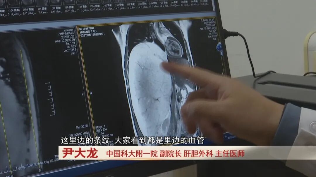 吓人！肚子痛忍忍就过？他拖到腹腔长出7斤“巨瘤”，医生6小时惊险“拆弹”