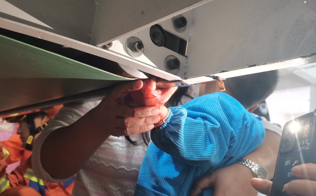 揪心!2岁娃手指被“咬”住,现场血流不止…… 揪心!2岁娃手指被“咬”住,现场血流不止……