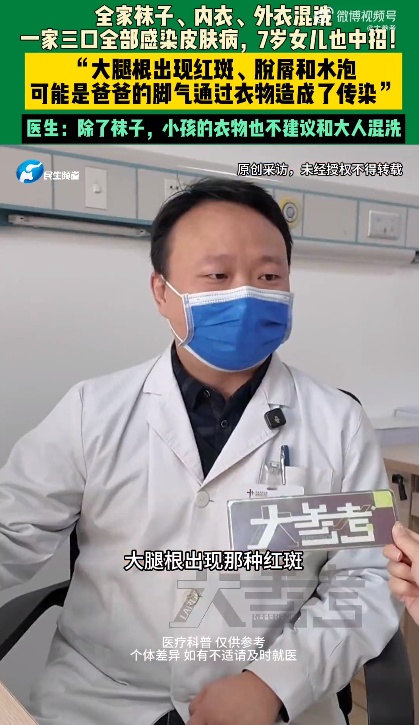 7岁女儿衣服与爸爸袜子混洗后感染脚气,医生:可引起毁容 7岁女儿衣服与爸爸袜子混洗后感染脚气,医生:可引起毁容