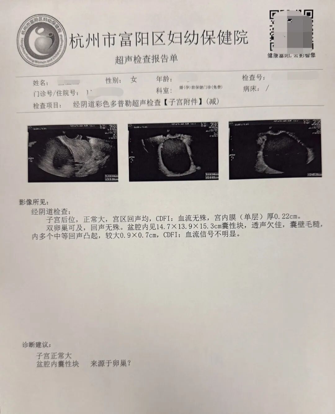 “幸好及时发现”，杭州一女士婚检发现异常！医生提醒：这项检查很重要