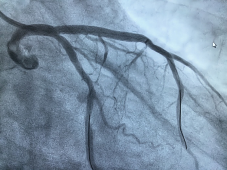一早连做2台手术!都有这个共同点…医生:不要忍、不要等! 一早连做2台手术!都有这个共同点…医生:不要忍、不要等!