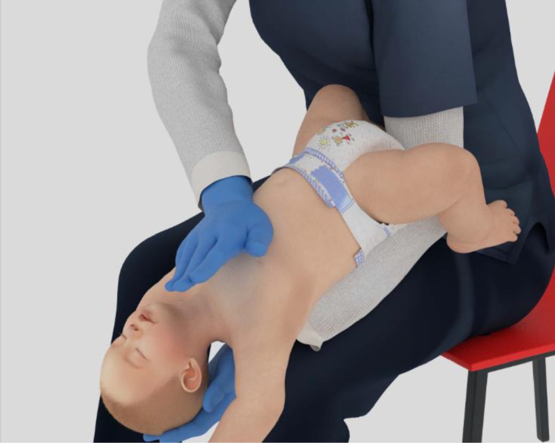 海姆立克急救法更新！赶紧学起来，关键时刻能救命！