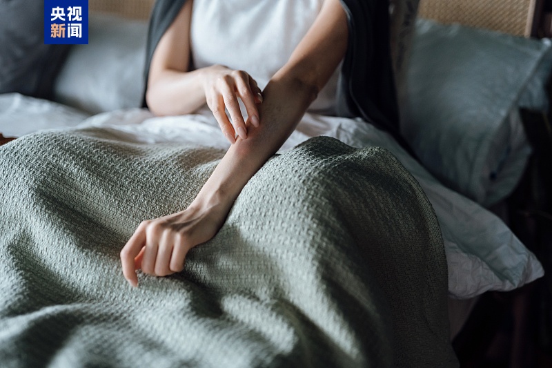 湿疹可能是“干”出来的 冬季皮肤瘙痒需警惕