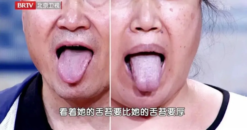 得结节的人越来越多？有这个特点的人可能是结节体质