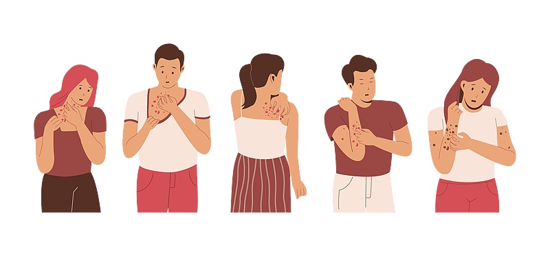 湿疹可能是“干”出来的 冬季皮肤瘙痒需警惕