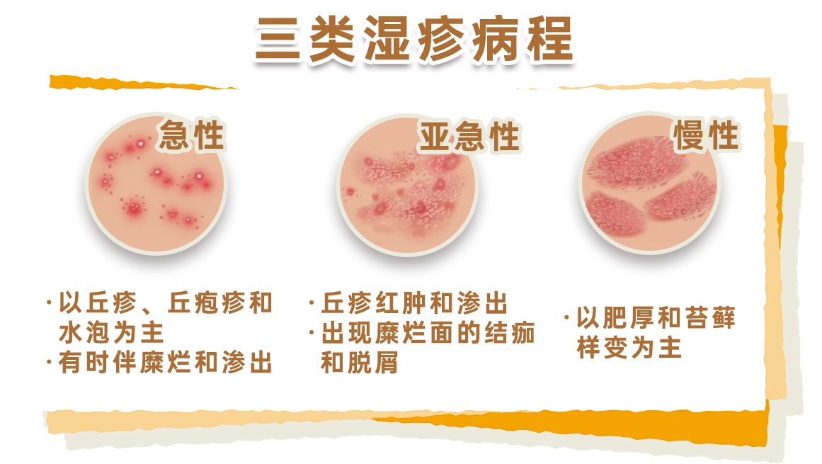 湿疹可能是“干”出来的 冬季皮肤瘙痒需警惕