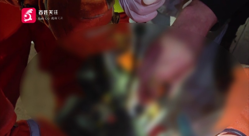 年关将至要小心!只因一个错误操作,女子手指被狠狠“咬住” 年关将至要小心!只因一个错误操作,女子手指被狠狠“咬住”