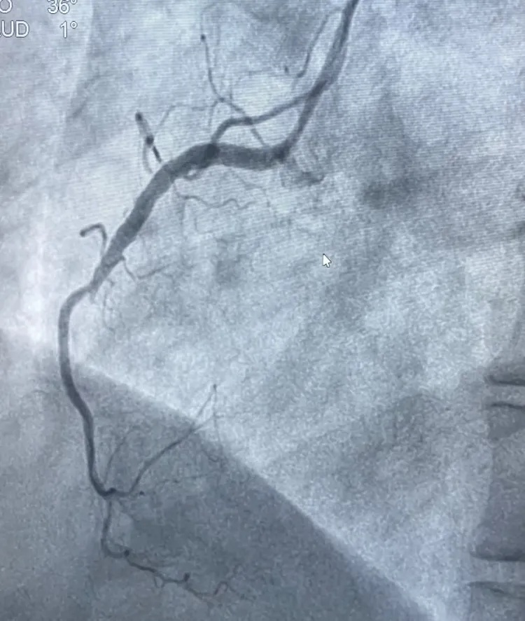 夫妻来浙江旅游因琐事拌嘴,妻子突然捂住胸口……医生:吵架真能气死人 夫妻来浙江旅游因琐事拌嘴,妻子突然捂住胸口……医生:吵架真能气死人