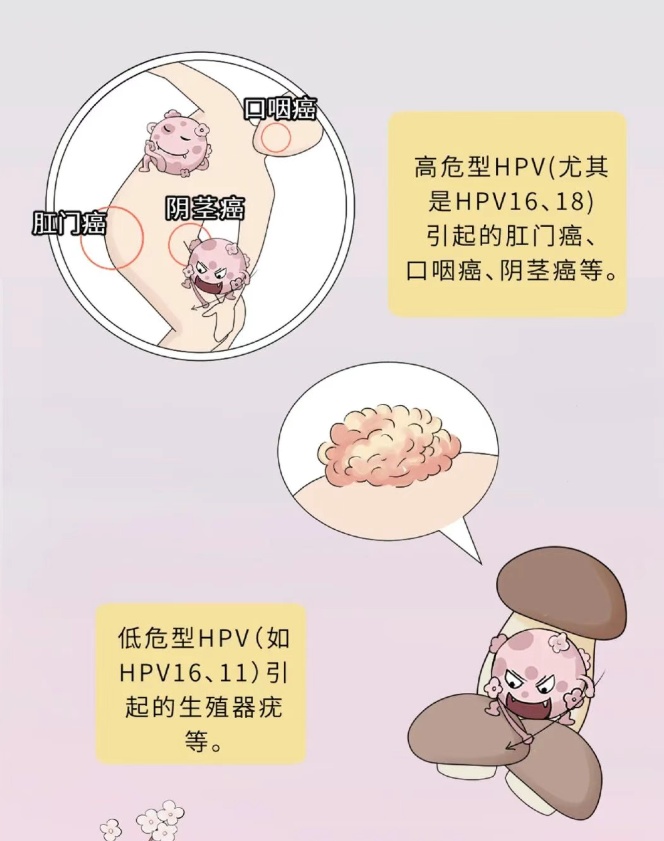 隐私部位全被切,男子瞬间崩溃:我怎么会得?医生:不能拖啊 隐私部位全被切,男子瞬间崩溃:我怎么会得?医生:不能拖啊