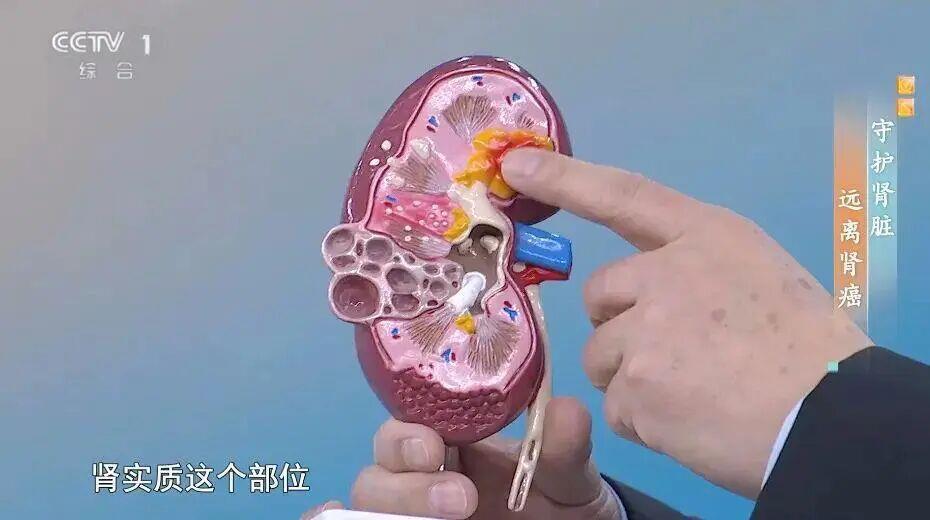 喝水后出现这5种情况 可能是身体在“求救”