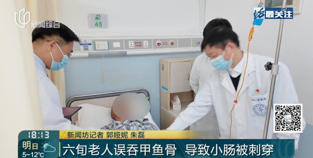 上海爷叔遭罪了！甲鱼骨头刺穿小肠！这种吃饭习惯请注意