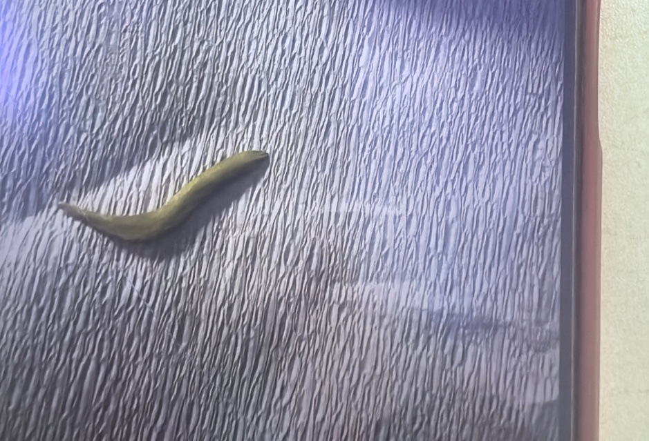 上海爷叔遭罪了！甲鱼骨头刺穿小肠！这种吃饭习惯请注意