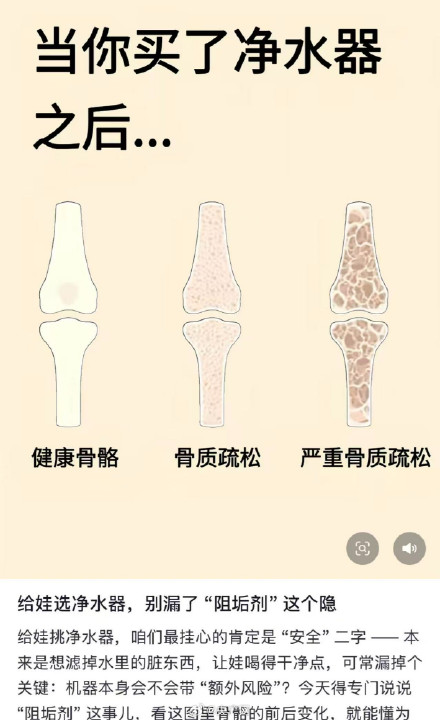 净水器阻垢剂致骨质疏松系谣言