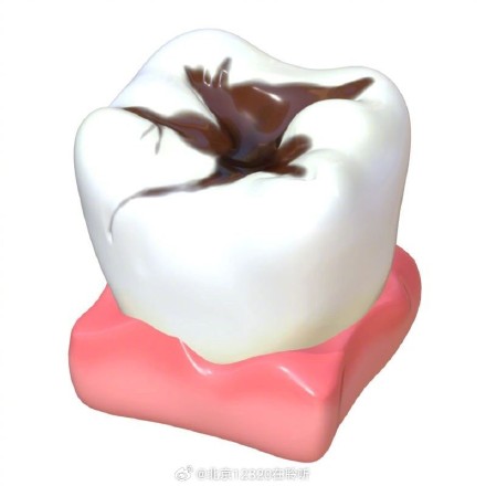 慢性牙髓炎发作时的疼痛有什么特点？