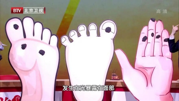 30岁之后出现的这种痣，恶变几率越高