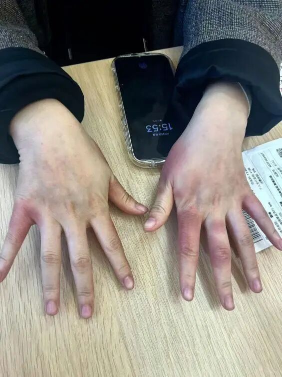 破防了！北方人遭南方过冬暴击，穿满“装备”仍扛不住湿冷，网友：懂这种痛