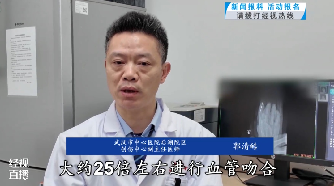 2岁男童手指被机器切断，医生用25倍显微镜和最细的缝线在0.1毫米级的血管上“绣花”