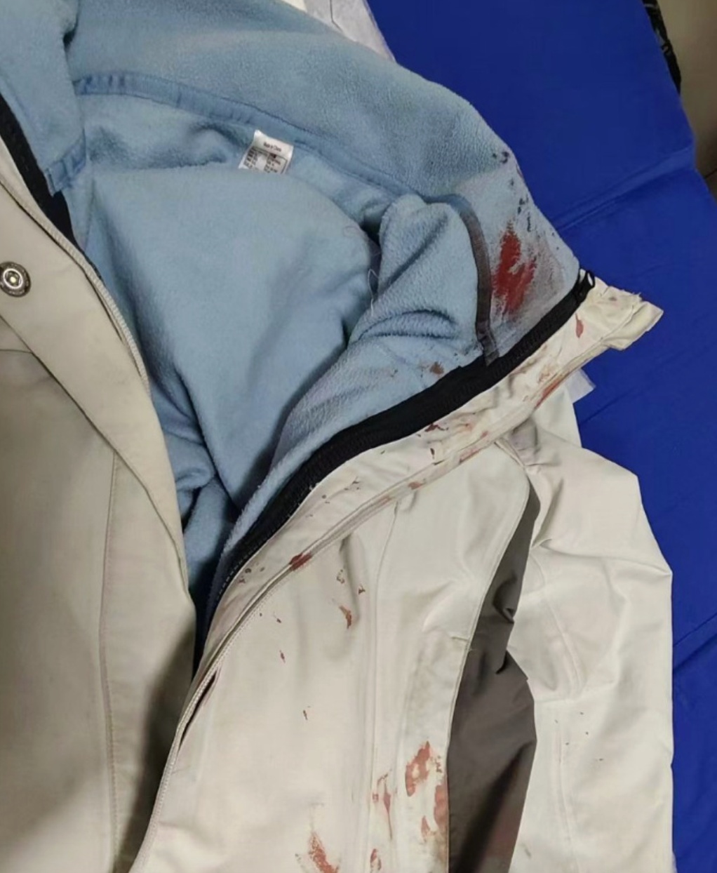 男子街头挥刀乱刺,她一脚踢落凶器:脸上缝了30多针“不后悔” 男子街头挥刀乱刺,她一脚踢落凶器:脸上缝了30多针“不后悔”