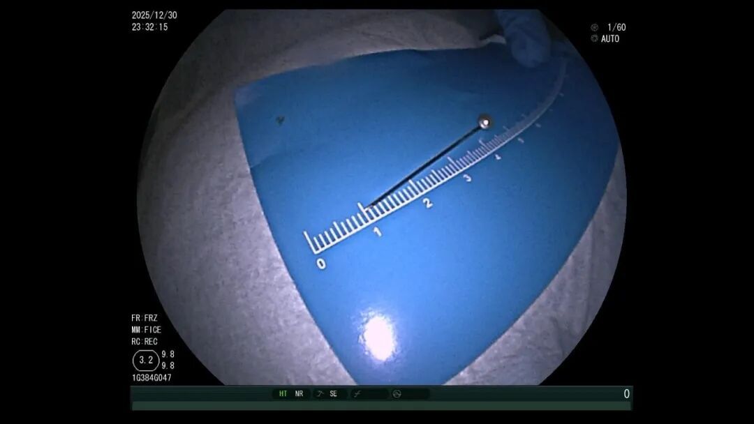 这“玩具”突然火了，杀伤力大！11岁男孩被紧急送医