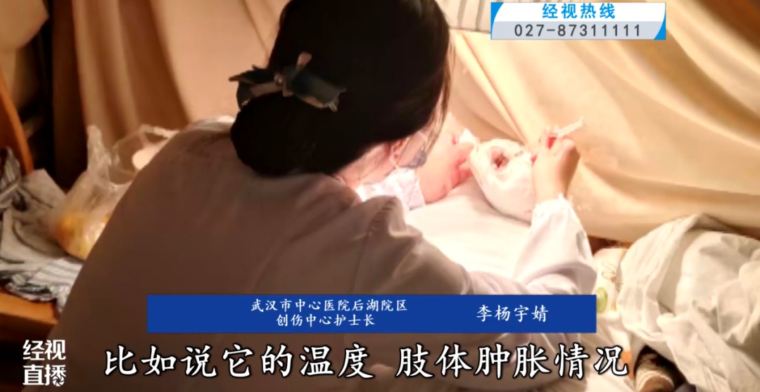 2岁男童手指被机器切断，医生用25倍显微镜和最细的缝线在0.1毫米级的血管上“绣花”