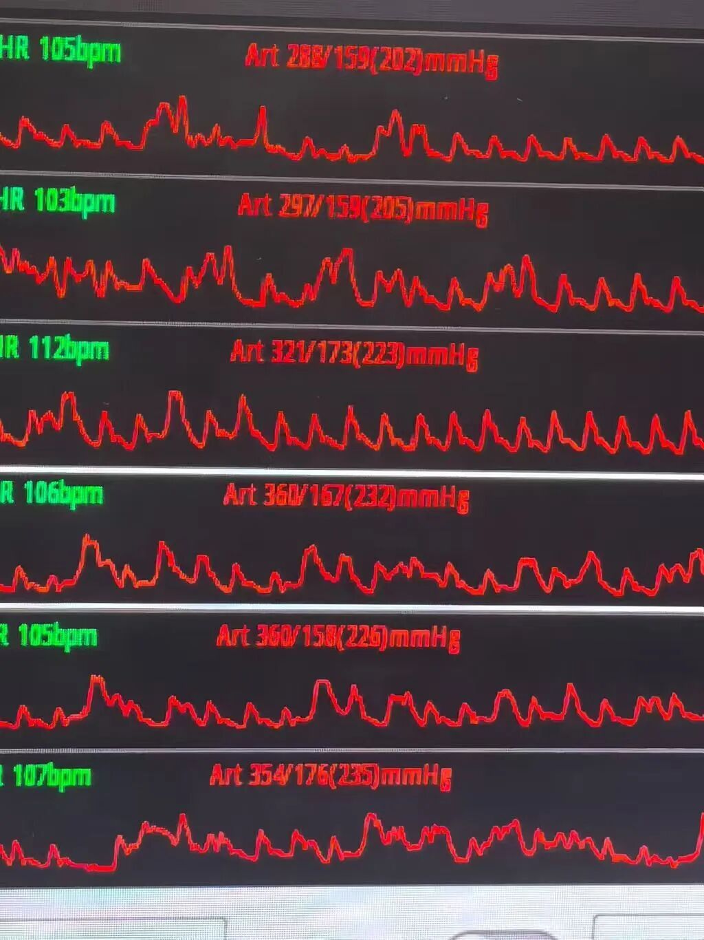 一夜之间！杭州30岁男子血压爆表晕厥，元凶就藏在冬季生活习惯里